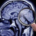 Un ragazzo sconfigge definitivamente il suo tumore al cervello dopo sette anni dalla diagnosi iniziale.