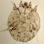 Cos’è la scabbia? Come si identifica e come prevenirla (dopo l’aumento dei casi)