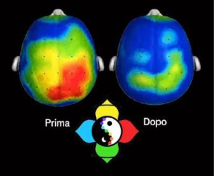 La neuroacustica è veramente efficace?